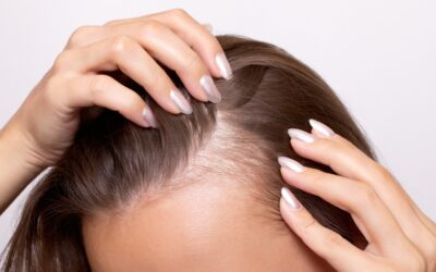 Hair Thinning? Don’t Overlook Iron